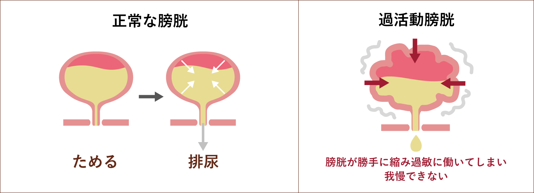 頻尿・過活動膀胱について